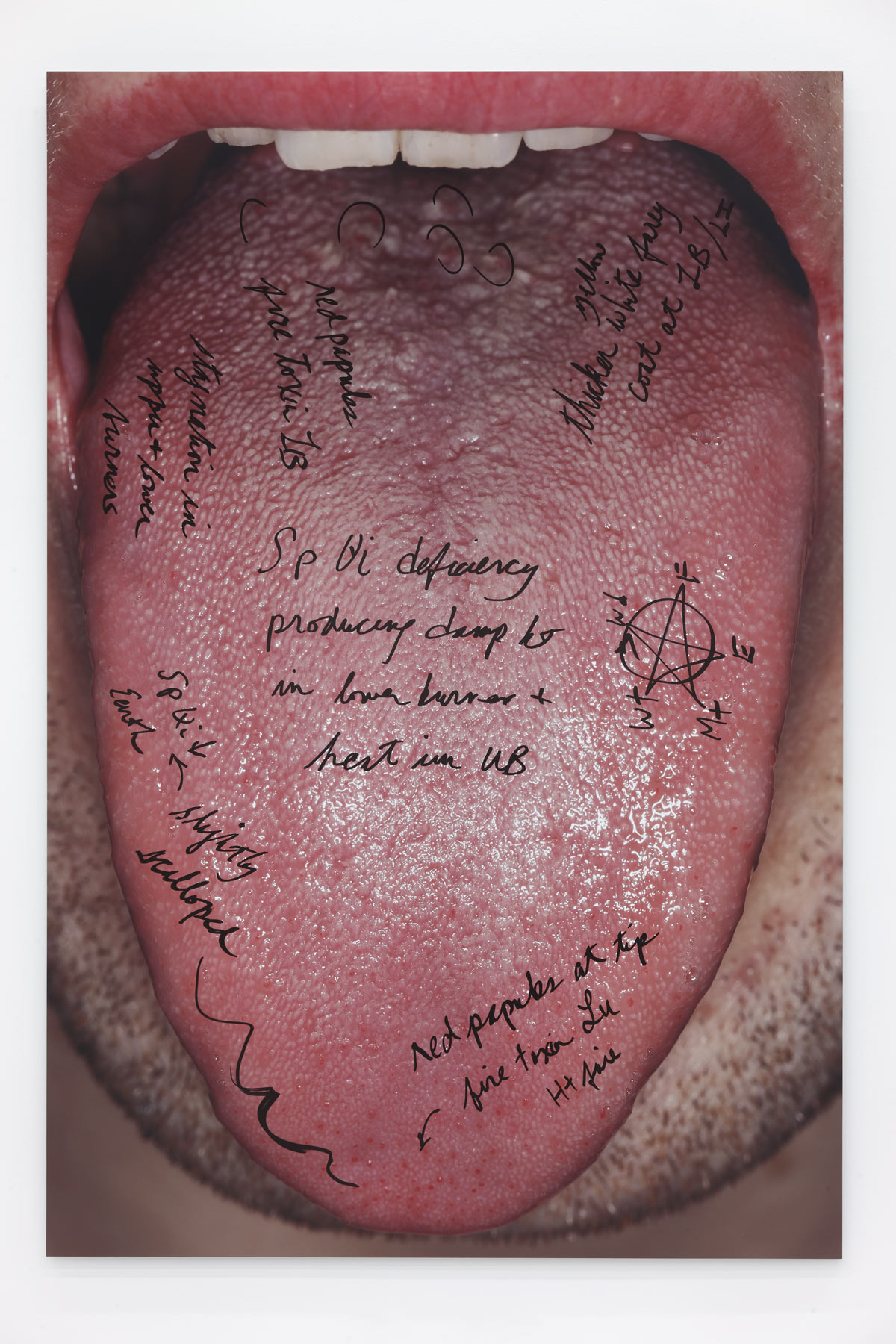 It’s Symptomatic… by Carissa Rodriguez