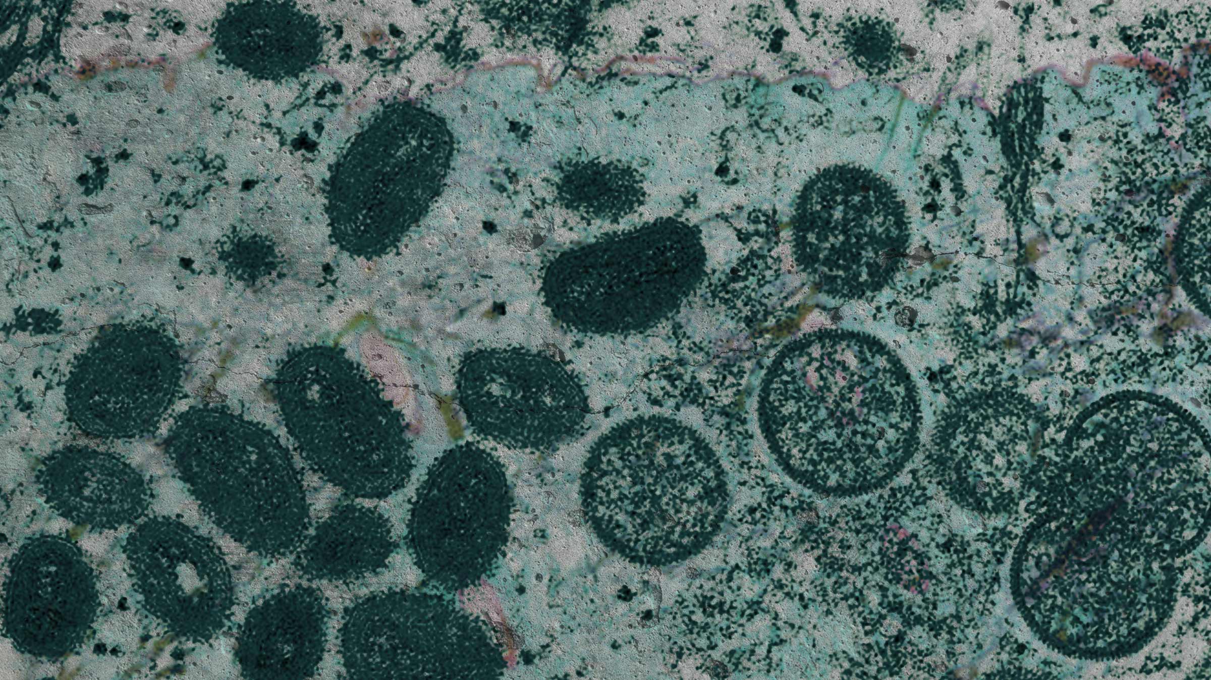 Monkeypox reveals the cultural capital of beauty in a chronically-online culture