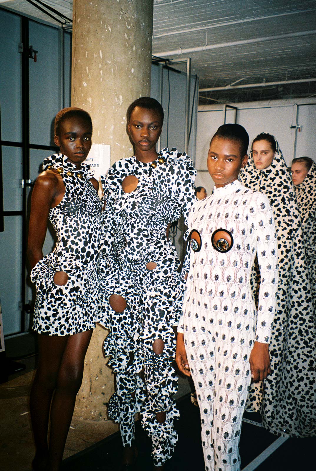 Area’s anatomy of an eye